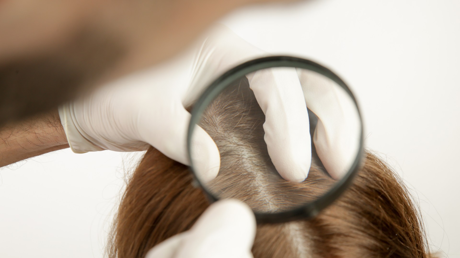 What Are the Stages of the Head Lice Life Cycle?