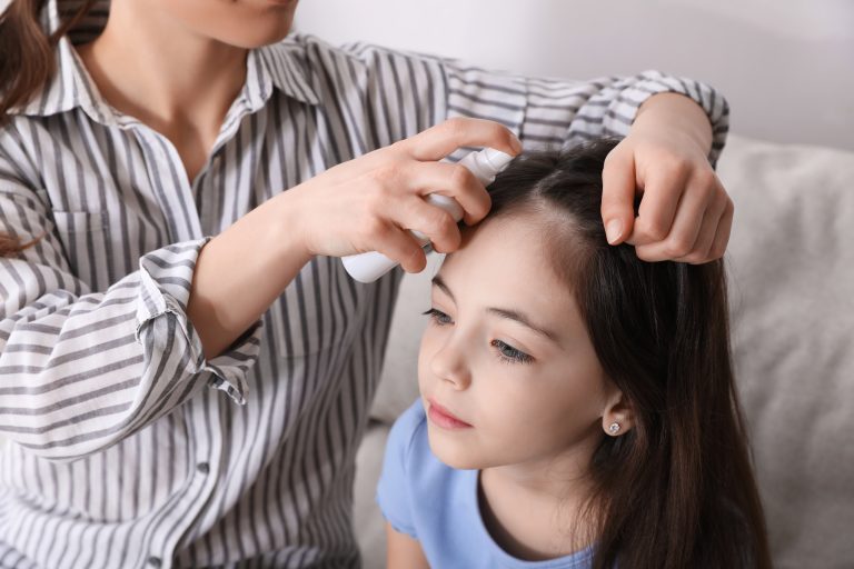 Do Lice Prevention Sprays Actually Work?