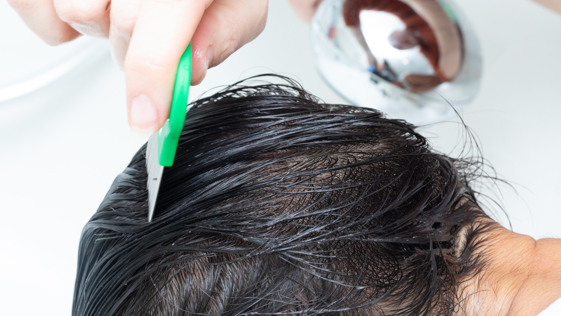 Clinician using a fine-tooth metal lice comb on a patient's conditioner-coated wet hair during a careful detection comb-out - the wet combing method the article describes.