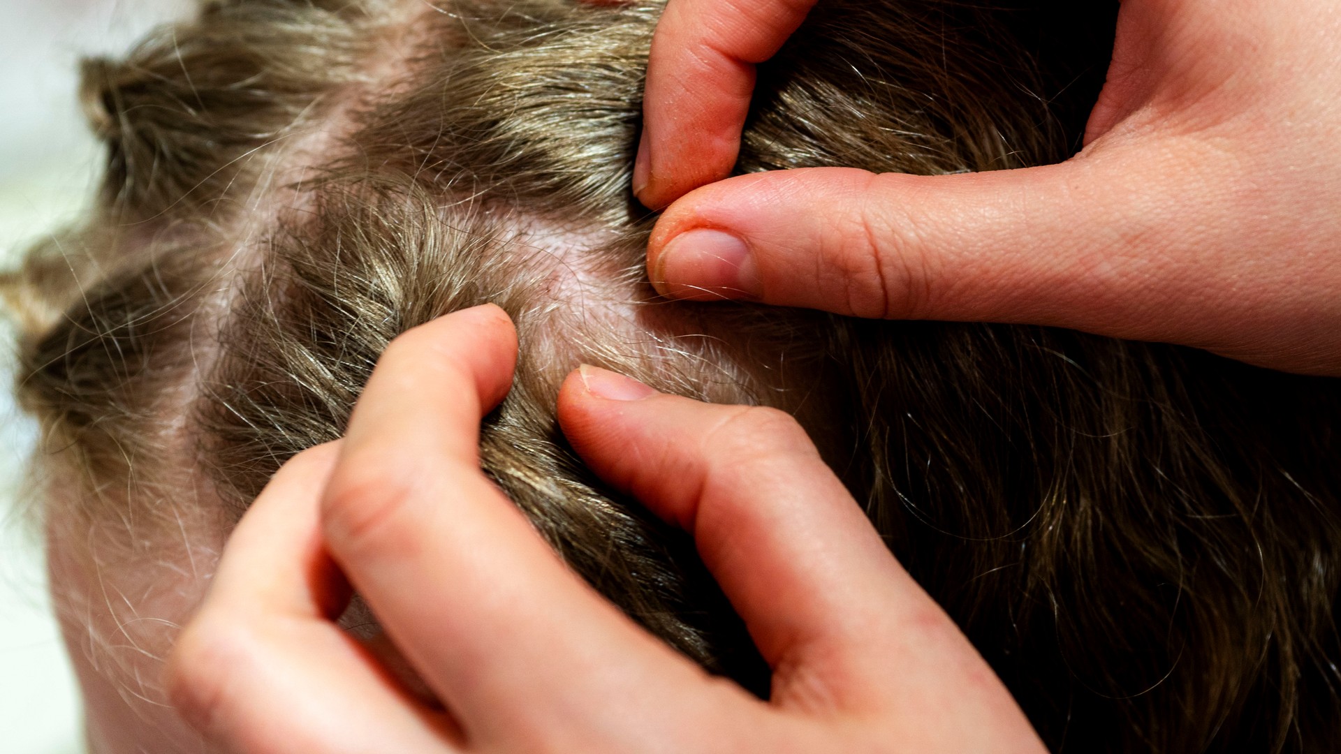 Parent checking a child's hair for head lice with a metal lice comb on a clean surface