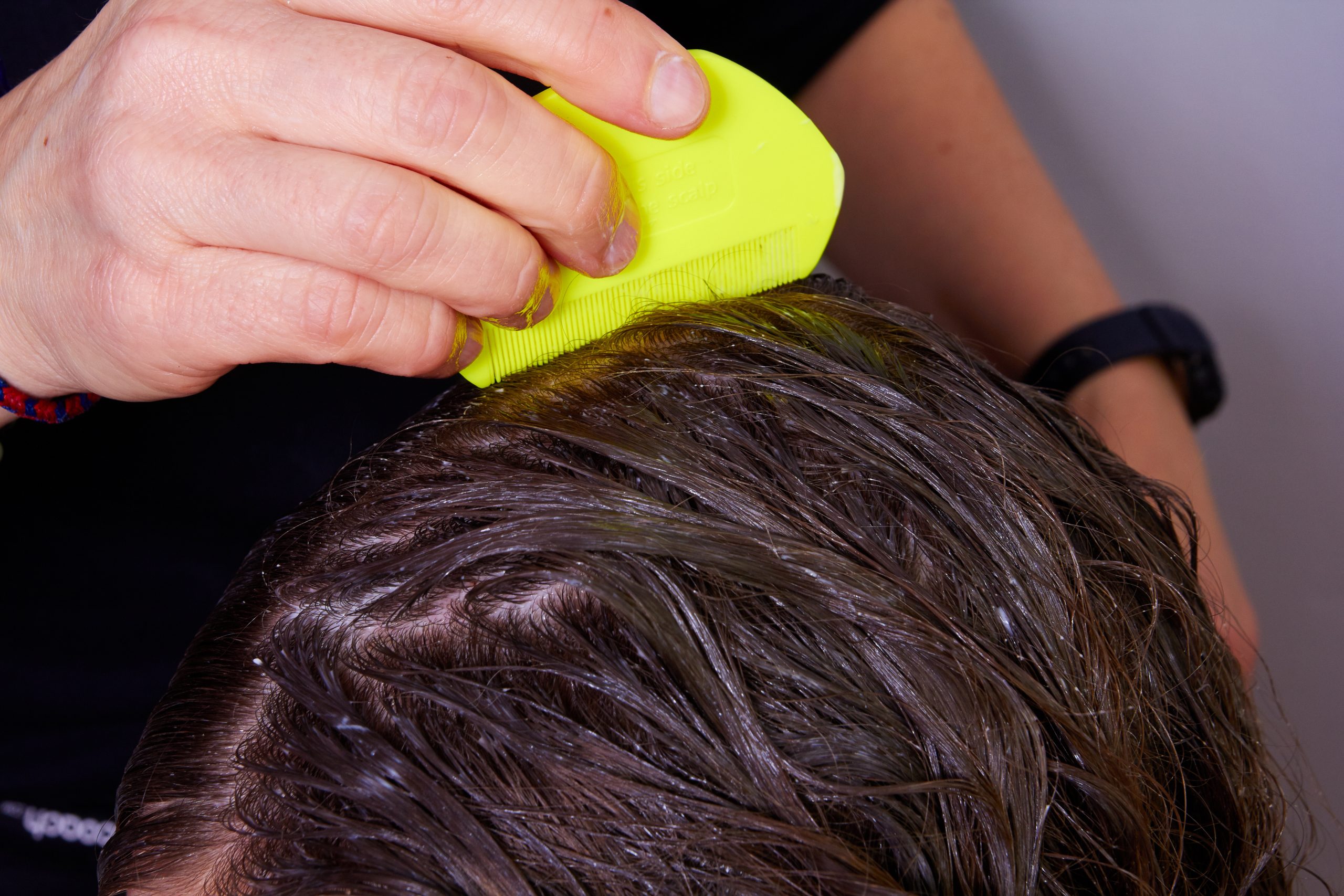 checking hair for lice