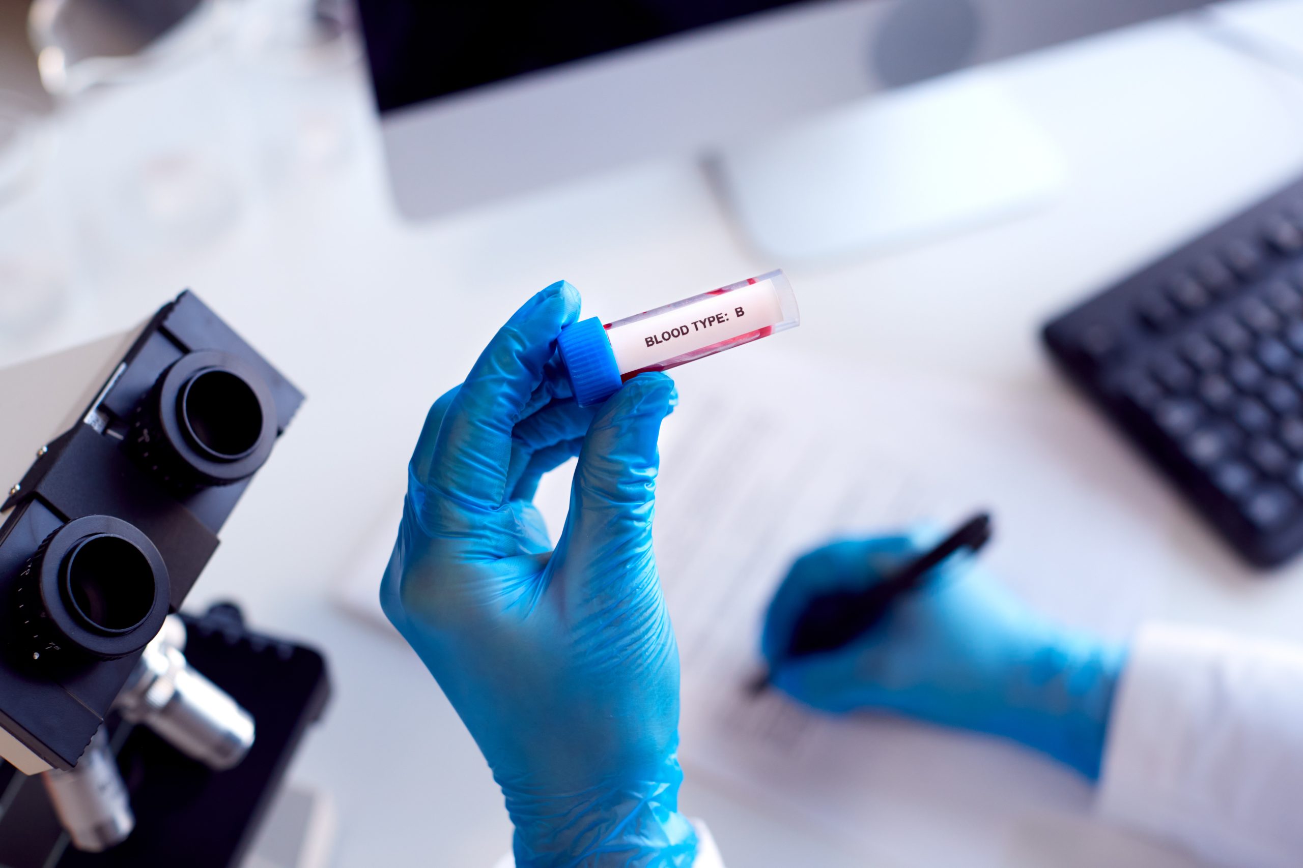 Blood type laboratory sample for article about head lice and blood types