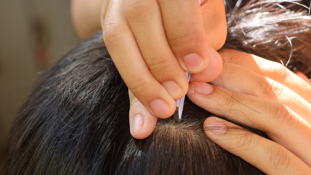 Timeline of a Lice Infestation
