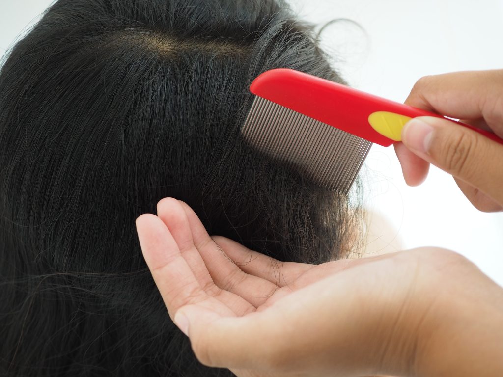 Can Lice Survive on Pillows, Furniture, and Clothing?