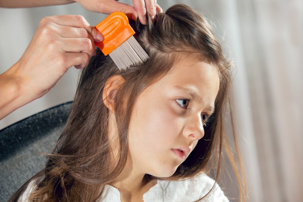 Lice Removal Products Compared