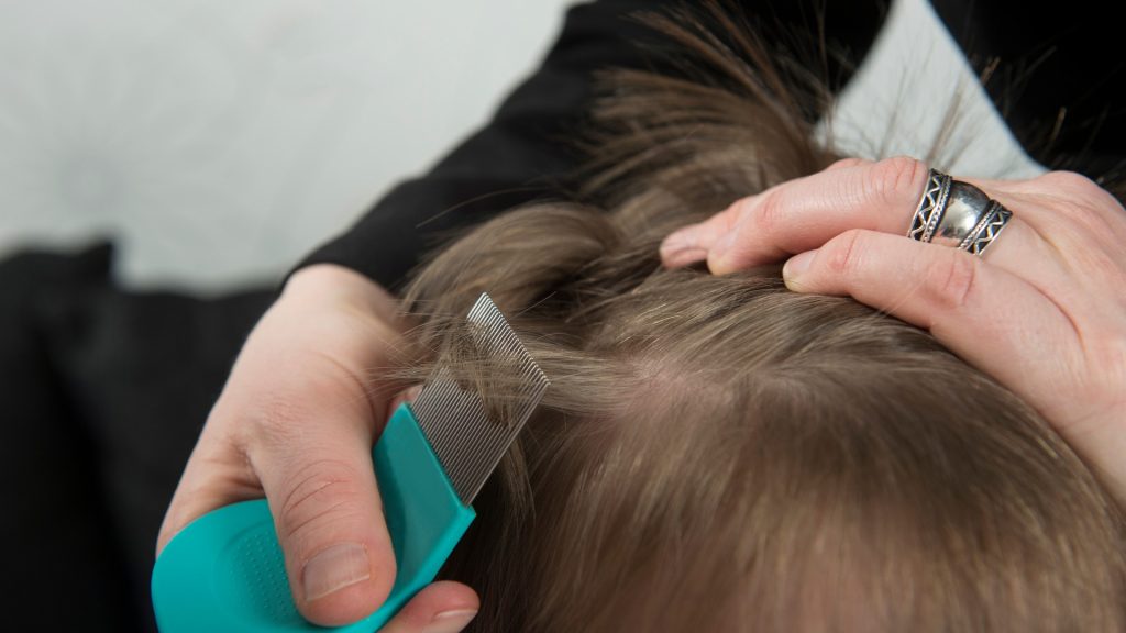 Most Effective Lice Treatment Options Compared for 2026