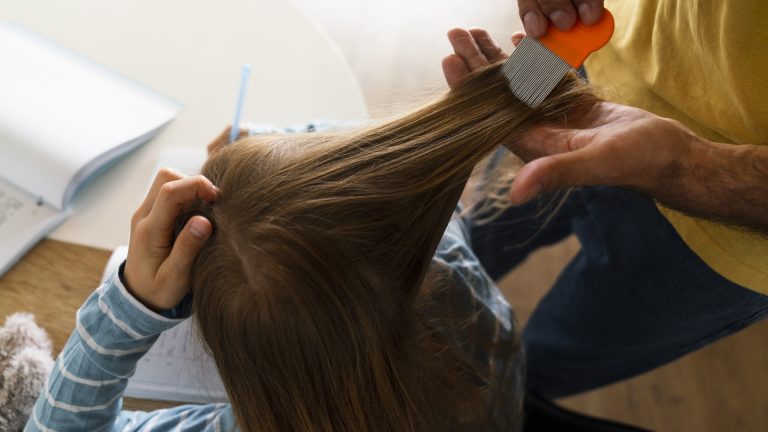 A Quarter Inch of Hair Tells You If the Lice Are Active